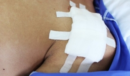 Nam sinh lớp 12 bị bạn đâm trước cổng trường