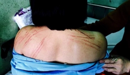 Vụ nữ LS bị đánh: Một cán bộ TAND tỉnh bị nhắc nhở vì phát ngôn bất cẩn