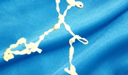 Phát hiện sán xơ mít hơn 1m trong bụng bệnh nhân