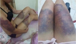 Tiết lộ sốc vụ cô gái bị bạn trai hành hung như thời trung cổ ở Hà Nội