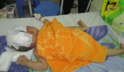Cứu sống bé trai 15 tháng tuổi bị chấn thương sọ não do TNGT