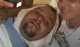 Sống sót thần kỳ dù bị lao sắt đâm xuyên mặt