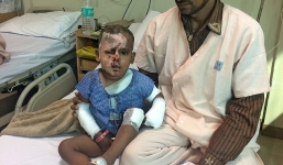 Ấn Độ: Bị cự tuyệt, kẻ theo đuổi mẹ hắt axit vào con trai 2 tuổi trả thù