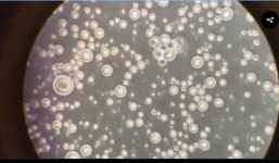 Video sữa mẹ dưới kính hiển vi thu hút hàng triệu lượt xem