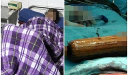 Vô sinh, cô vợ bị chồng đút chày 40 cm vào người