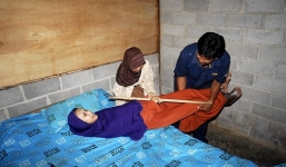 Bệnh lạ khiến cô gái trở thành pho tượng sống