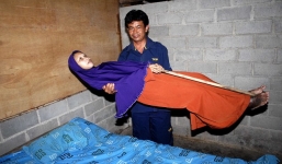 Mắc bệnh lạ, người phụ nữ không thể gập được người