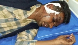 Nữ y tá tạt axit, rạch mặt người yêu cũ vì bỏ đi lấy vợ