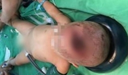 Bị cha ném cốc trúng đầu, bé trai hơn 2 tháng tuổi tử vong 