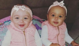 Hiện tượng 'hiếm' triệu người mới có một: 2 chị em sinh đôi khác màu da
