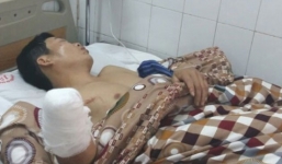 Hậu quả từ đốt pháo ngày Tết: người cụt tay, kẻ mù mắt