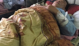 Trạm trưởng Y tế xã bị chồng nhân viên cấp dưới chém nhập viện