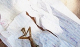 Bé sơ sinh giống ếch tại Zimbabwe