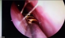 Video: Kinh hoàng cảnh tượng gián bò trong hộp sọ người