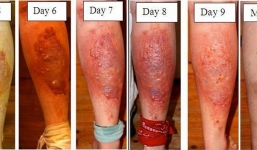 Loài cây kỳ lạ có thể gây mù mắt vĩnh viễn chỉ bằng một lần chạm