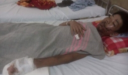 Thiếu niên hỏng mắt, bỏng nặng do nghịch pháo tự chế