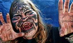 Những ca phẫu thuật thẩm mỹ kỳ quặc nhất thế giới