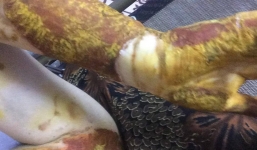 Hà Nội: Khiển trách hiệu trưởng trường có nữ sinh bị bỏng ở phòng thực hành