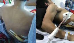 Vụ bị đâm khi cứu cô gái gặp tai nạn: Nạn nhân bị thương nằm gục ở vỉa hè
