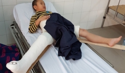 Xe chở hiệu trưởng đâm gãy chân học sinh: Bộ trưởng bộ giáo dục đề nghị xử lý nghiêm