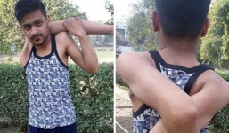 Video: Hy hữu chàng trai có cánh tay dẻo như bún