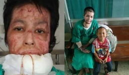 Chồng tẩm xăng thiêu sống vợ khi đang nấu ăn vì lý do ghen tuông