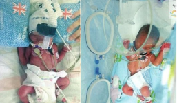 Hy hữu người mẹ sinh 2 lần chỉ cách nhau 1 tuần