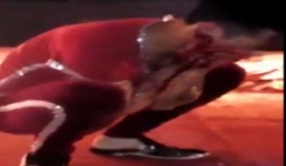 Nam diễn viên bị cá sấu cắn vào mặt khi biểu diễn ở hội chợ