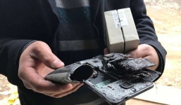 Bố sạc điện thoại để đầu giường, con gái 5 tuổi bị bỏng nặng