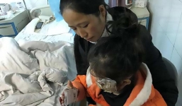 Note 4 phát nổ khiến khuôn mặt bé gái 5 tuổi biến dạng