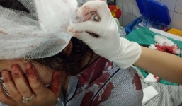 Nữ sinh bị đánh rách đầu, gãy tay ngay tại cổng trường ở Hà Nội