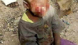 Bé 4 tuổi bị mẹ kế bạo hành vì tè dầm