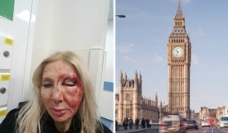 Nữ du khách bị đánh vì từ chối nói chuyện với người lạ