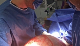 Cứu sống cô gái có khối u 'to như cái trống', nặng 32kg