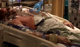 Người đàn ông nhập viện vì đau bụng, không ngờ phải cắt chân tay