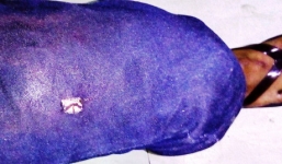 Lao xe vào tổ công tác, tài xế ô tô tử vong nghi do trúng đạn