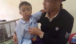 Đốt pin điện thoại, hai anh em bị nổ nát tay