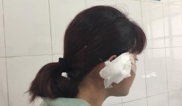 Nữ giáo viên khiêu vũ tố bị phụ huynh hành hung cắn đứt tai