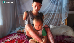 Cám cảnh ông bố 9x cụt 2 tay chăm con thơ dại, vợ lạnh lùng bỏ đi