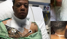 Sạc iPhone trên giường, người đàn ông bị điện giật