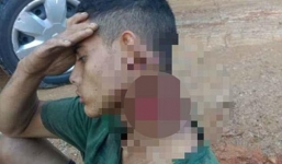 Bị cướp chém gần nửa cổ, chàng trai đi bộ 500m tìm người giúp