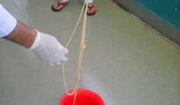 Cụ bà sống chung với sán sơ mít dài 5m trong cơ thể nhiều năm trời