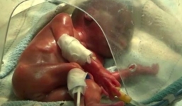 Bé sơ sinh sống lại sau khi được gia đình chuẩn bị hỏa táng