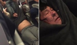 ​United Airlines mất 1 tỉ USD sau vụ lôi hành khách gốc Việt xuống máy bay