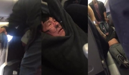 Vụ bác sĩ gốc Việt bị kéo khỏi máy bay: 37.000 người đòi CEO hãng bay từ chức