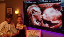 Bố mẹ bất ngờ với hình ảnh siêu âm thai sinh đôi