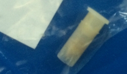 Hóc dị vật khiến cậu bé ho ra tiếng kèn