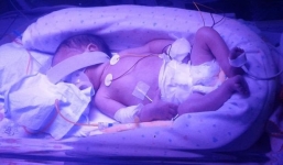 Hy hữu mẹ chết gần 4 tháng vẫn sinh con khỏe mạnh