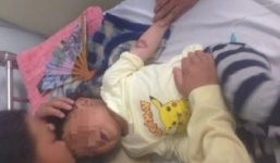 Bé 3 tuổi ăn nhầm gói hóa chất bị bỏng thực quản - dạ dày