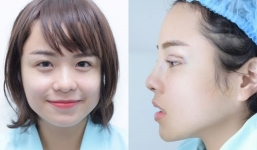 Thái Trinh thừa nhận sử dụng dao kéo để cải thiện nhan sắc